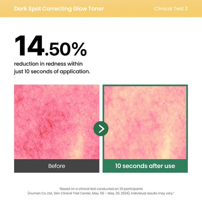 AXIS-Y Dark Spot Correcting Glow Toner with 5% Niacinamide, 4.23 fl. oz. | 98% Pure Glutathione, 5% Niacinamide, BHA & Hyaluronic Acid Improve Skin.