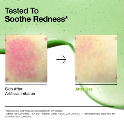 ANUA Azelaic Acid Redness Soothing Serum 30ml | Korean Skincare